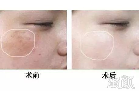 https://img.miyanlife.com/mnt/timg/181006/1110333Y6-4.jpg