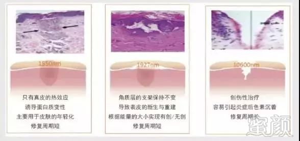 https://img.miyanlife.com/mnt/timg/181006/11111WR1-0.jpg