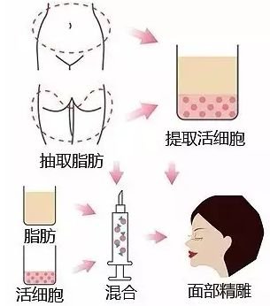 https://img.miyanlife.com/mnt/timg/181006/111S31I1-6.jpg
