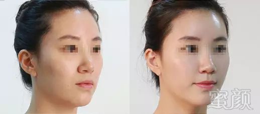 https://img.miyanlife.com/mnt/timg/181006/1142101025-4.jpg