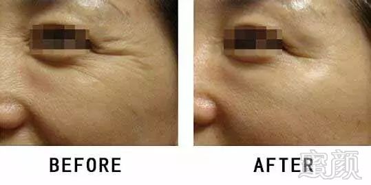 https://img.miyanlife.com/mnt/timg/181006/11463613E-6.jpg