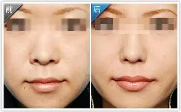 https://img.miyanlife.com/mnt/timg/181006/12101B450-10.jpg