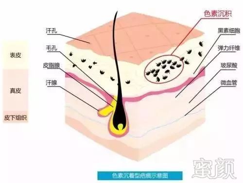 https://img.miyanlife.com/mnt/timg/181006/1212521037-6.jpg