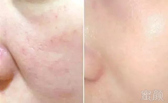 https://img.miyanlife.com/mnt/timg/181006/12125244Q-4.jpg