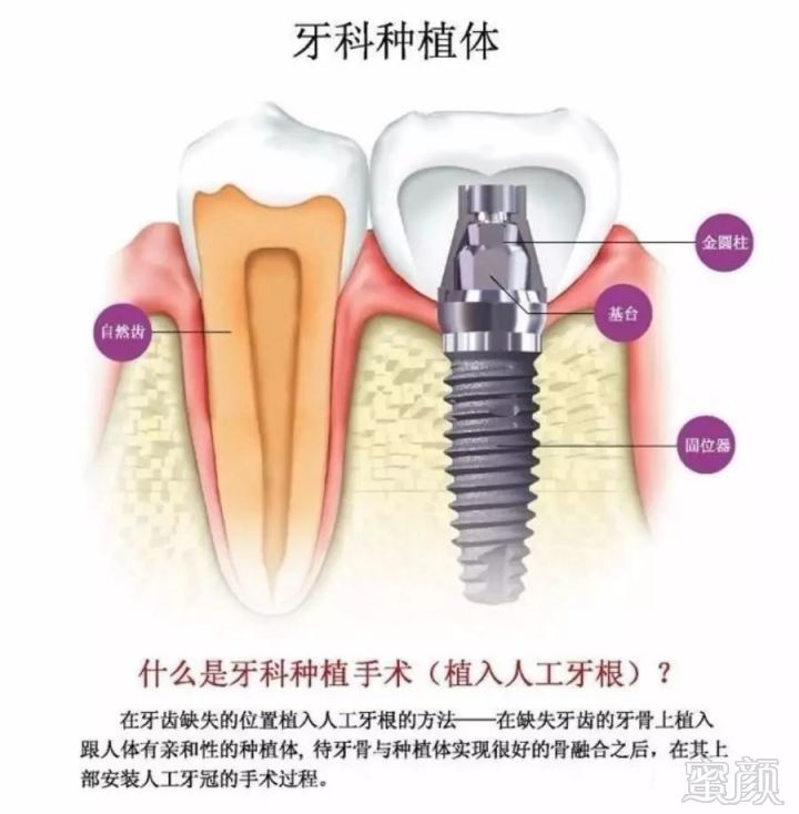 案例图片