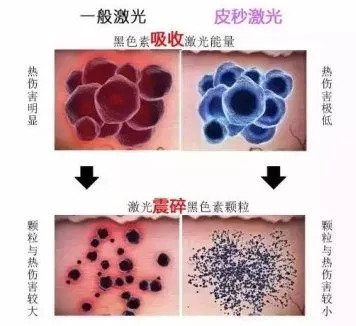 https://img.miyanlife.com/mnt/timg/181007/1214441521-3.jpg