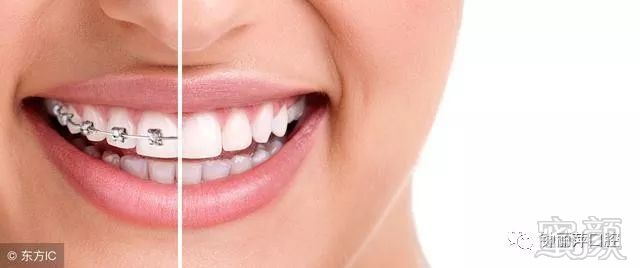 https://img.miyanlife.com/mnt/timg/181007/12161C430-0.jpg