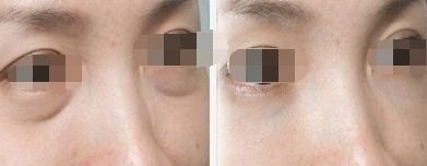 https://img.miyanlife.com/mnt/timg/181007/12195G342-2.jpg