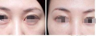 https://img.miyanlife.com/mnt/timg/181007/12195G361-3.jpg
