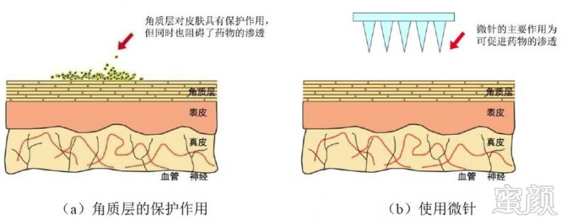 https://img.miyanlife.com/mnt/timg/181007/1226241608-0.jpg