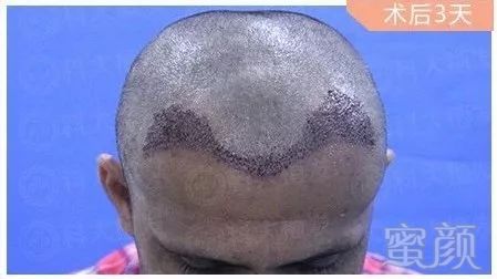 https://img.miyanlife.com/mnt/timg/181007/1250361R6-2.jpg