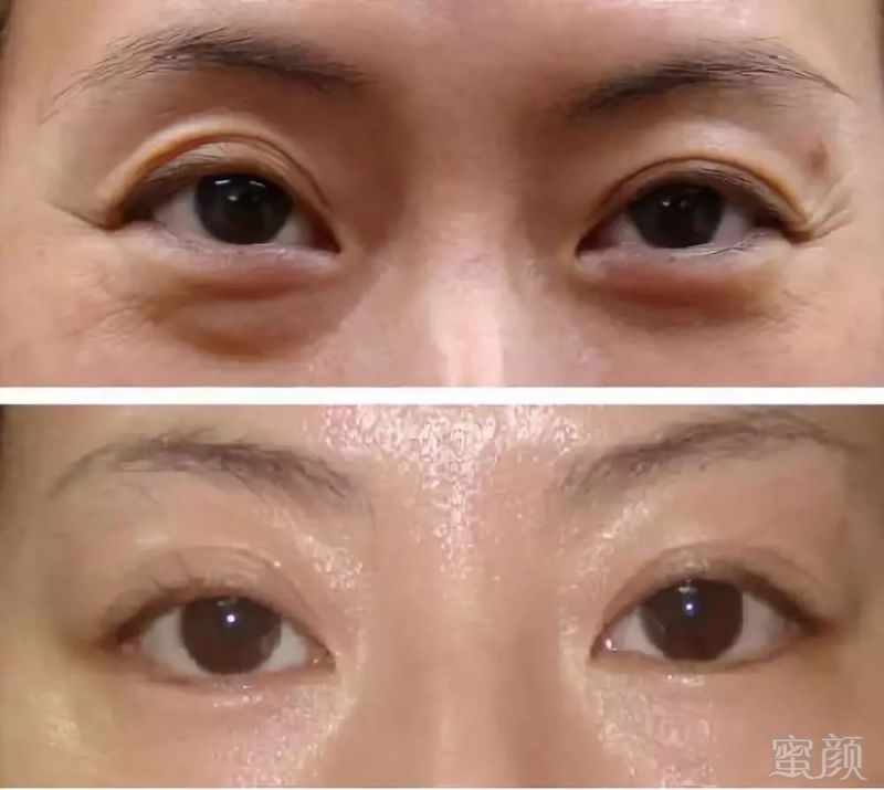 https://img.miyanlife.com/mnt/timg/181007/1300164G6-1.jpg