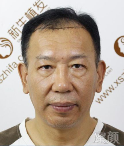 https://img.miyanlife.com/mnt/timg/181007/1335092362-5.jpg