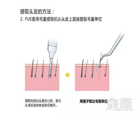 https://img.miyanlife.com/mnt/timg/181007/13350Q062-0.jpg
