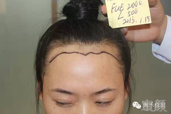 https://img.miyanlife.com/mnt/timg/181007/1336113Q0-2.jpg