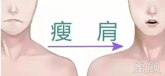https://img.miyanlife.com/mnt/timg/181008/12130544J-6.jpg