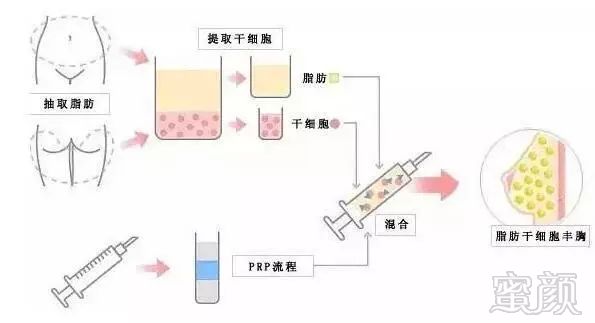 案例图片