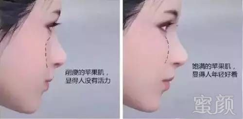https://img.miyanlife.com/mnt/timg/181008/1222552321-3.jpg