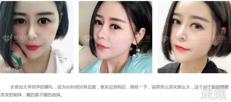 https://img.miyanlife.com/mnt/timg/181008/1259533141-4.jpg