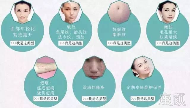 https://img.miyanlife.com/mnt/timg/181008/1303263926-3.jpg