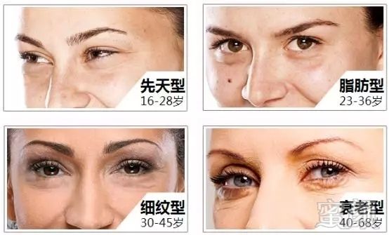 https://img.miyanlife.com/mnt/timg/181008/164S3HY-2.jpg