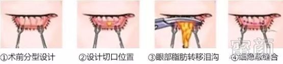 https://img.miyanlife.com/mnt/timg/181008/164S51914-5.jpg