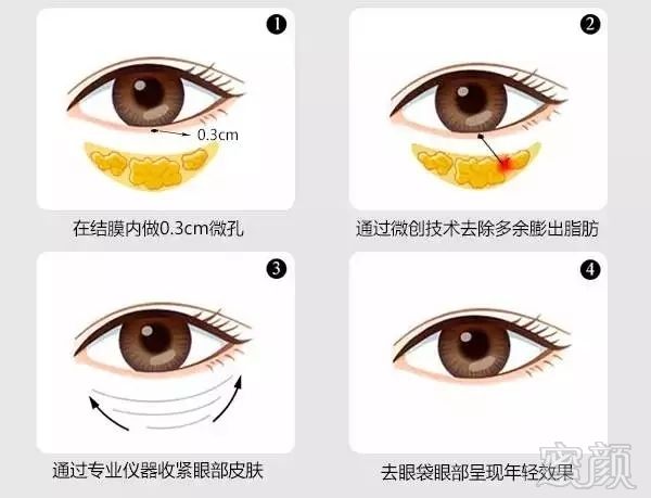https://img.miyanlife.com/mnt/timg/181008/164S562M-6.jpg