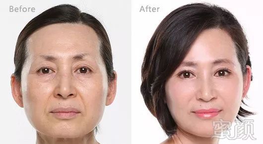 https://img.miyanlife.com/mnt/timg/181009/1224264G8-3.jpg