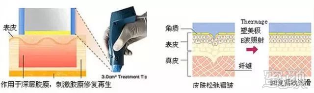 https://img.miyanlife.com/mnt/timg/181009/12251I5a-3.jpg