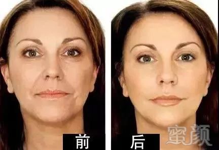 https://img.miyanlife.com/mnt/timg/181009/12251JN6-4.jpg