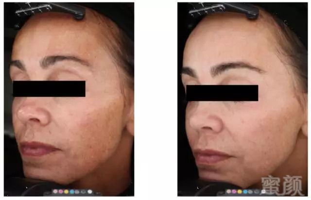 https://img.miyanlife.com/mnt/timg/181009/12493R029-9.jpg