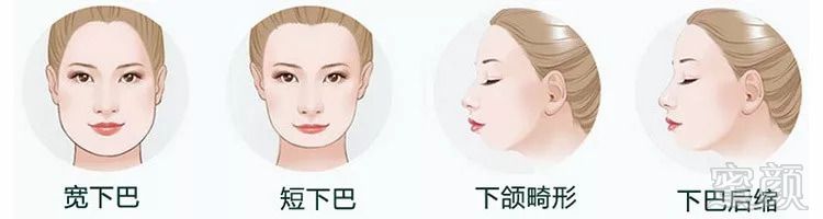 https://img.miyanlife.com/mnt/timg/181009/13252014A-10.jpg