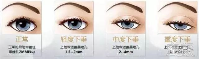 https://img.miyanlife.com/mnt/timg/181009/133Q43521-5.jpg