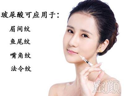 https://img.miyanlife.com/mnt/timg/181009/1G231H14-0.jpg