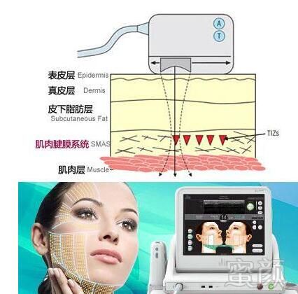 案例图片