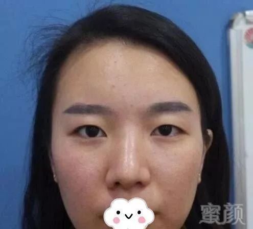 https://img.miyanlife.com/mnt/timg/181010/103K22119-0.jpg