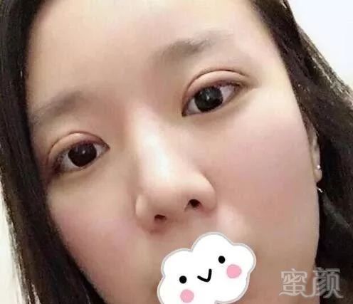 https://img.miyanlife.com/mnt/timg/181010/103K24118-1.jpg