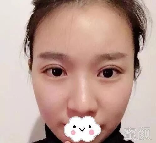 https://img.miyanlife.com/mnt/timg/181010/103K311W-2.jpg