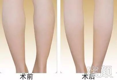 https://img.miyanlife.com/mnt/timg/181010/105553A60-2.jpg