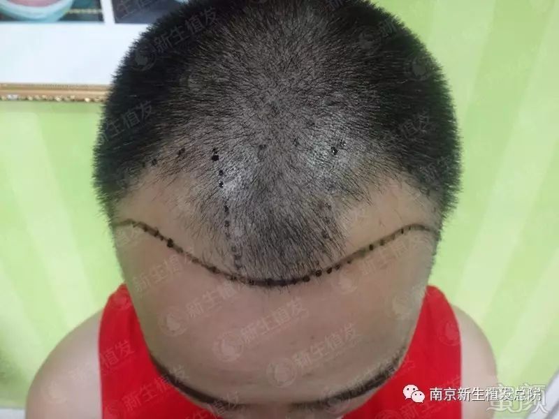 https://img.miyanlife.com/mnt/timg/181010/112R42493-0.jpg