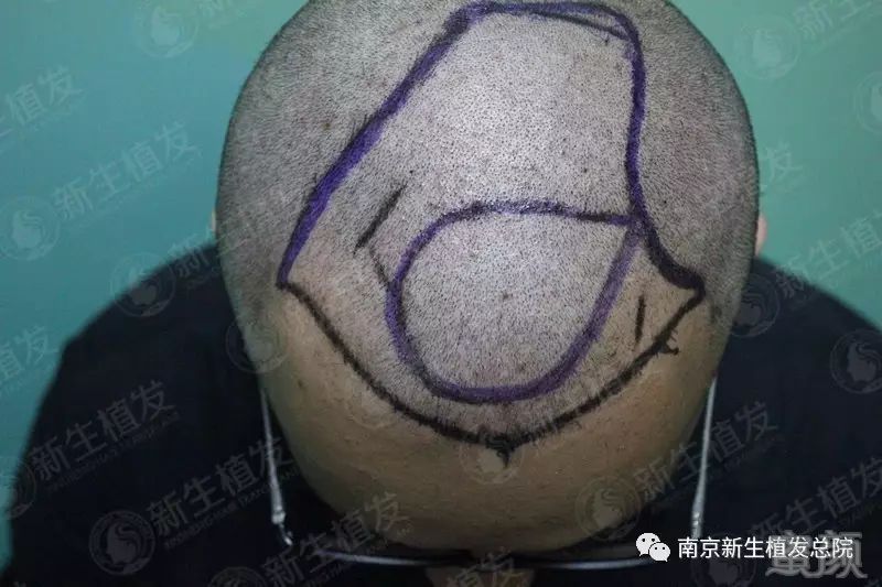 https://img.miyanlife.com/mnt/timg/181010/120I41263-1.jpg