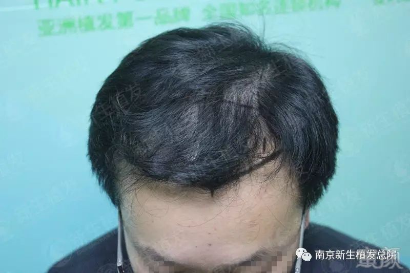 https://img.miyanlife.com/mnt/timg/181010/120I42359-0.jpg