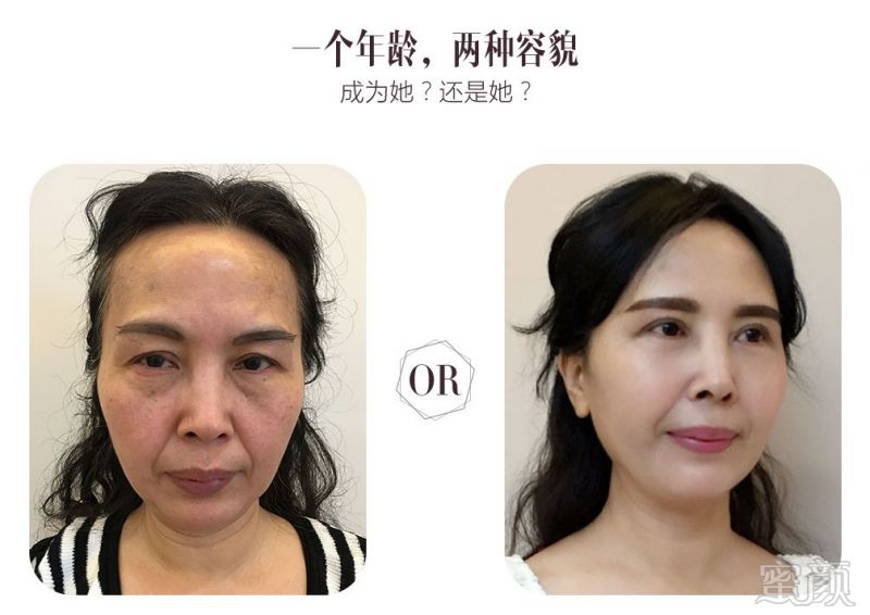 https://img.miyanlife.com/mnt/timg/181010/12494211M-0.jpg
