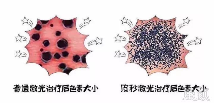https://img.miyanlife.com/mnt/timg/181010/124Q241L-7.jpg