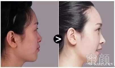 https://img.miyanlife.com/mnt/timg/181010/13054064G-0.jpg