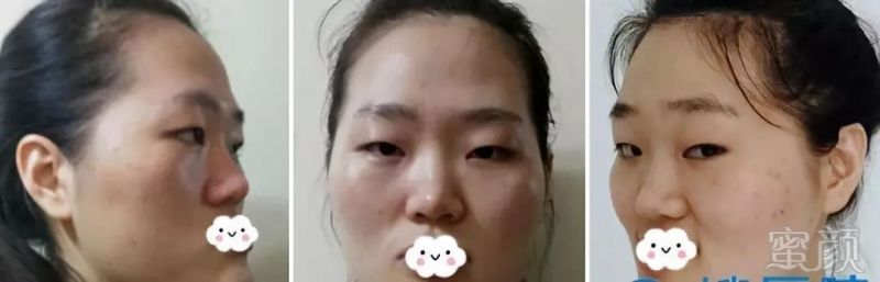 https://img.miyanlife.com/mnt/timg/181011/120031L14-0.jpg