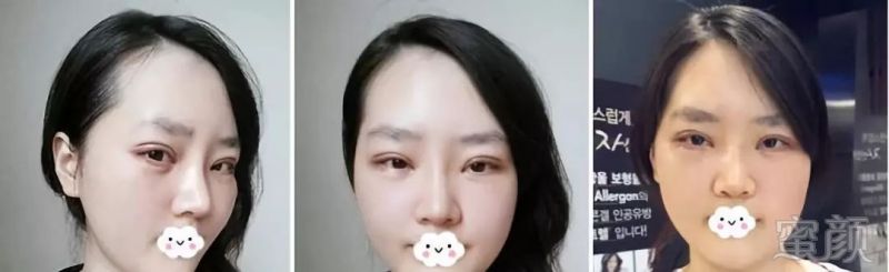 https://img.miyanlife.com/mnt/timg/181011/12003320S-2.jpg
