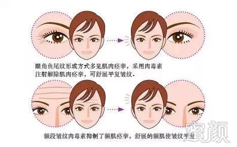 https://img.miyanlife.com/mnt/timg/181011/124613D17-5.jpg