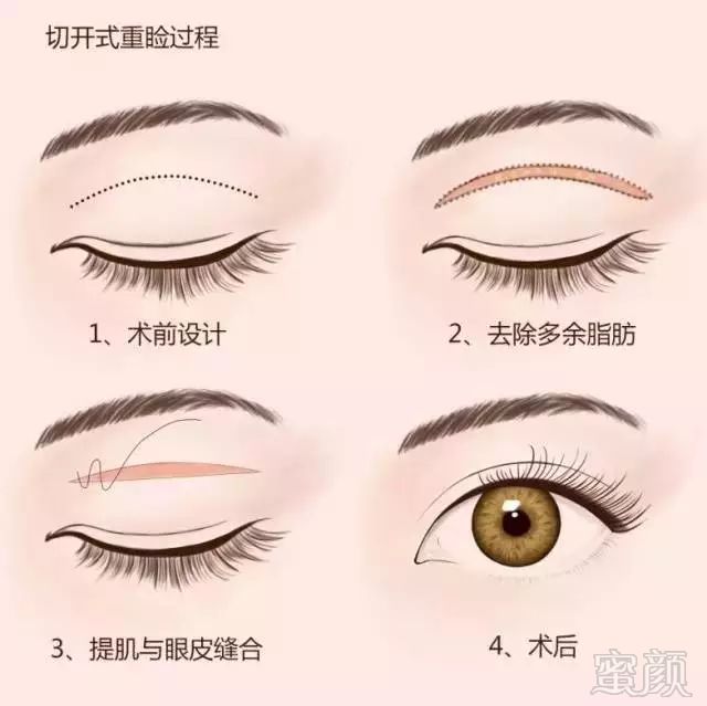 https://img.miyanlife.com/mnt/timg/181011/124P32U9-1.jpg