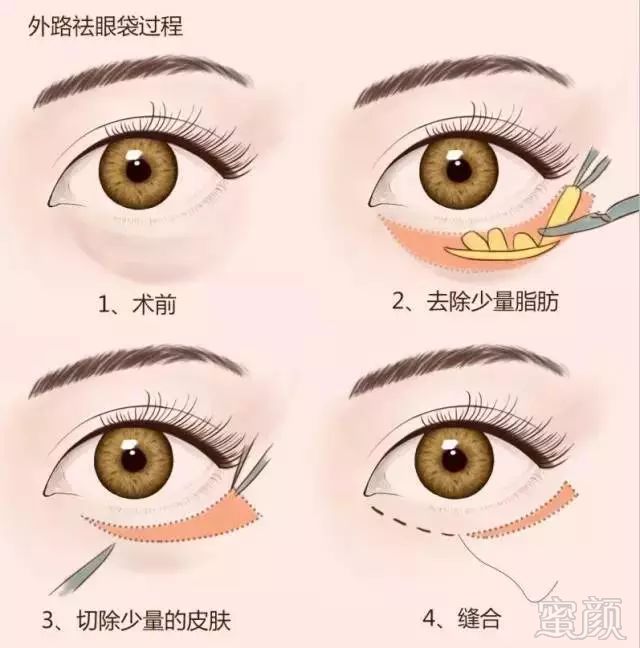https://img.miyanlife.com/mnt/timg/181011/124P35031-4.jpg